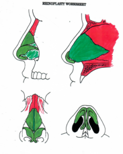 partes de la nariz